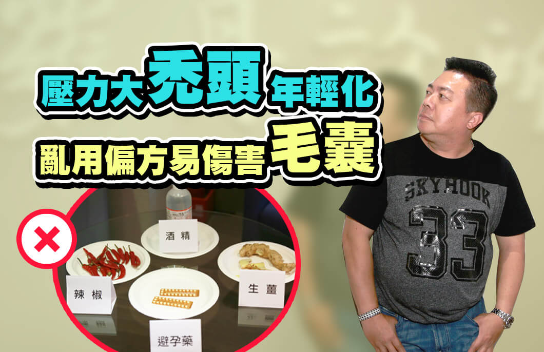 壓力大禿頭年輕化 網購盛行亂用偏方易傷害毛囊